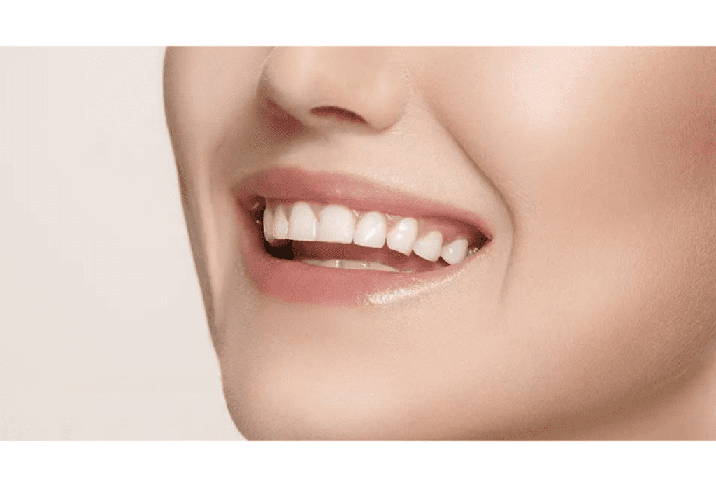 Teeth whitening Tips