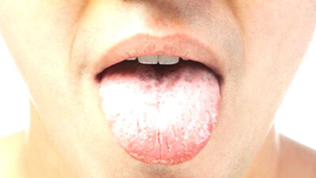 Tongue reveals health(Image source-Google)
