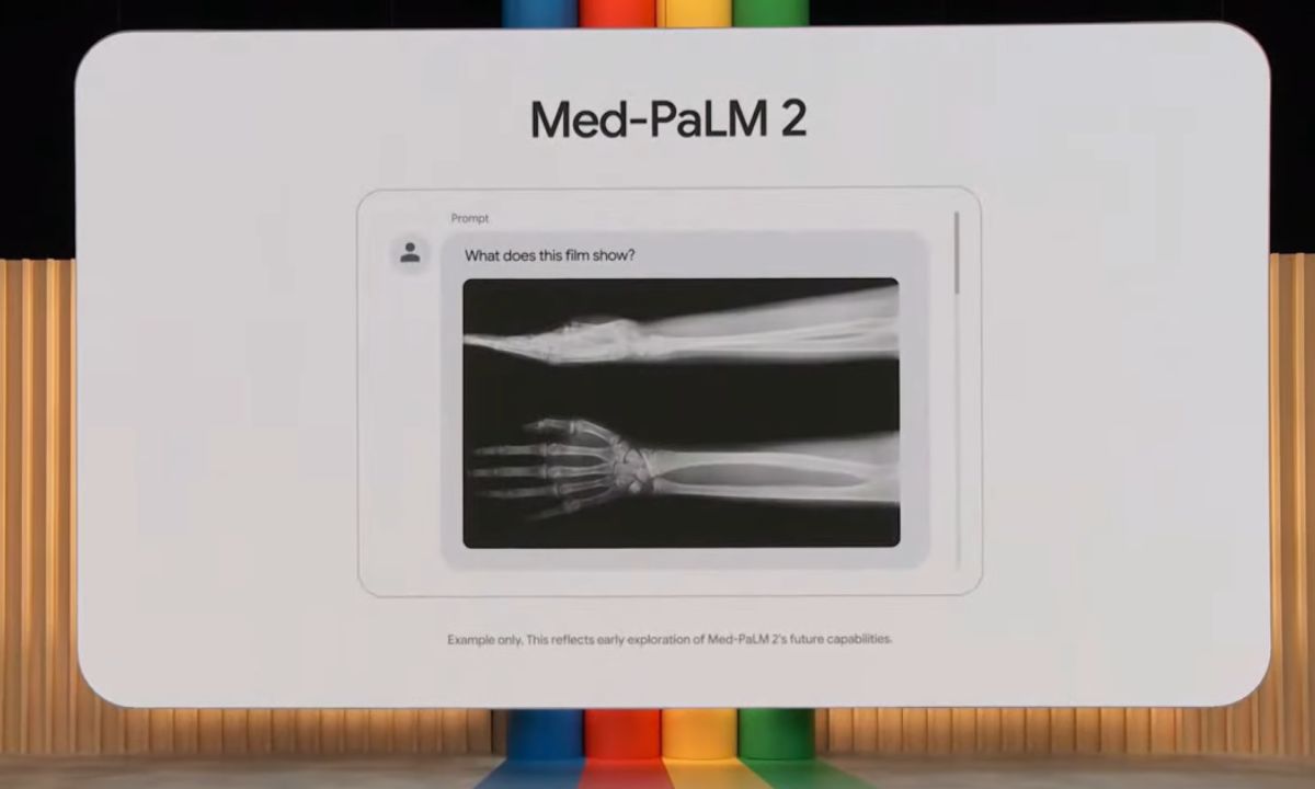 Med- PALM 2