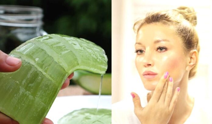 Aloe Vera for Acne