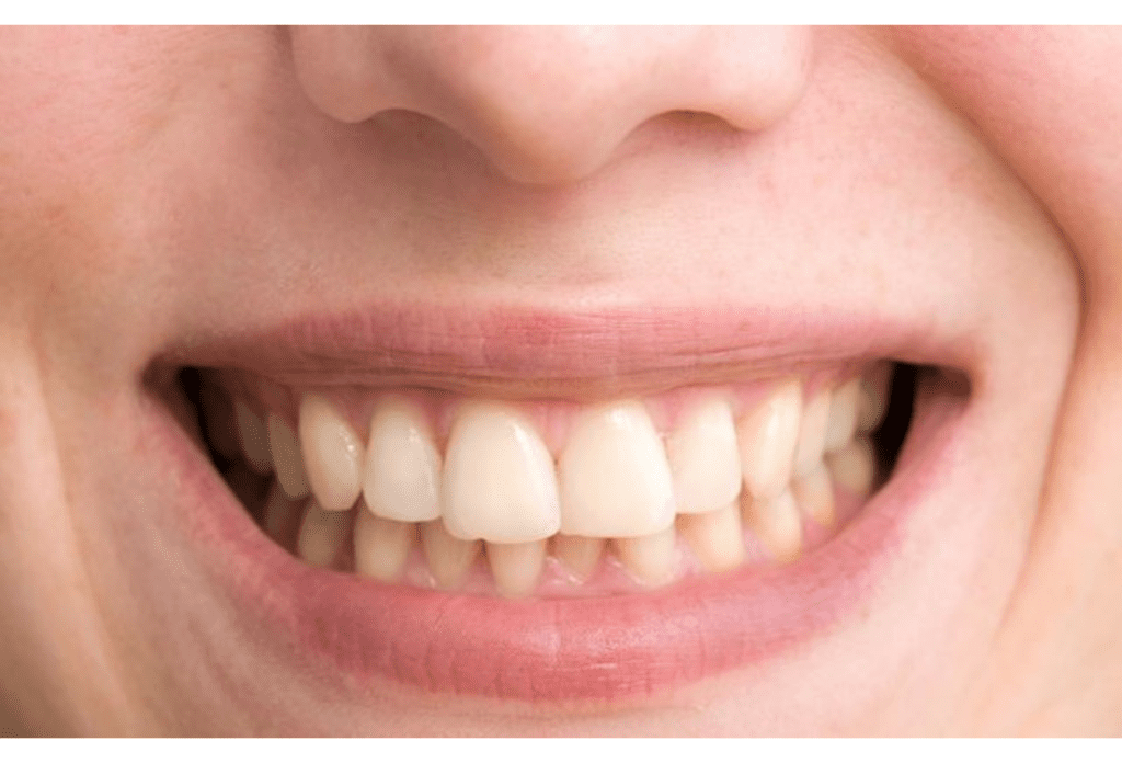 White teeth home remedies