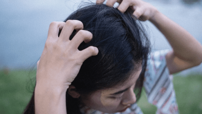 Itchy Scalp