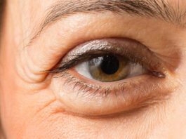 Eye Swelling