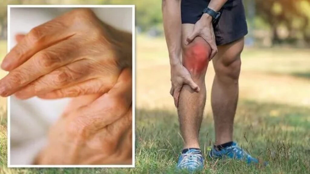 Arthritis Remedies