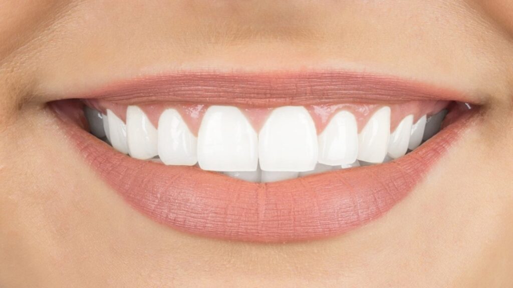 White Teeth