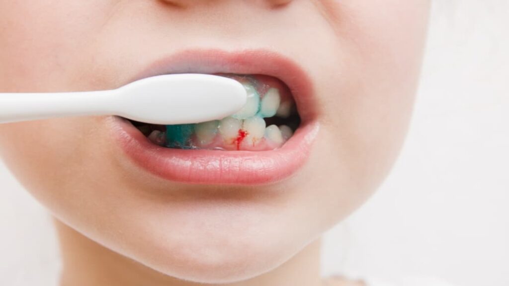 Teeth Cancer