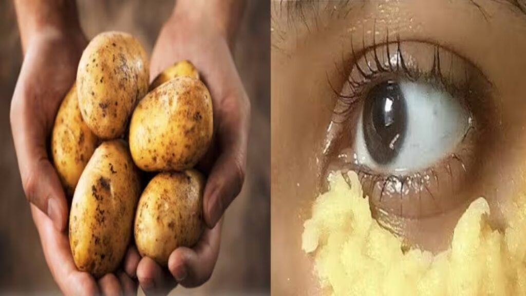 Potato for eyes